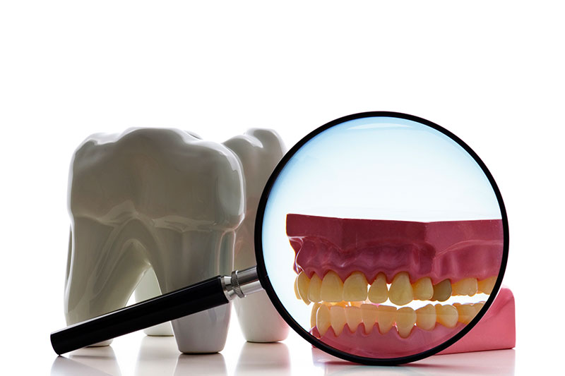 Root Canal Treatment in Litchfield Park