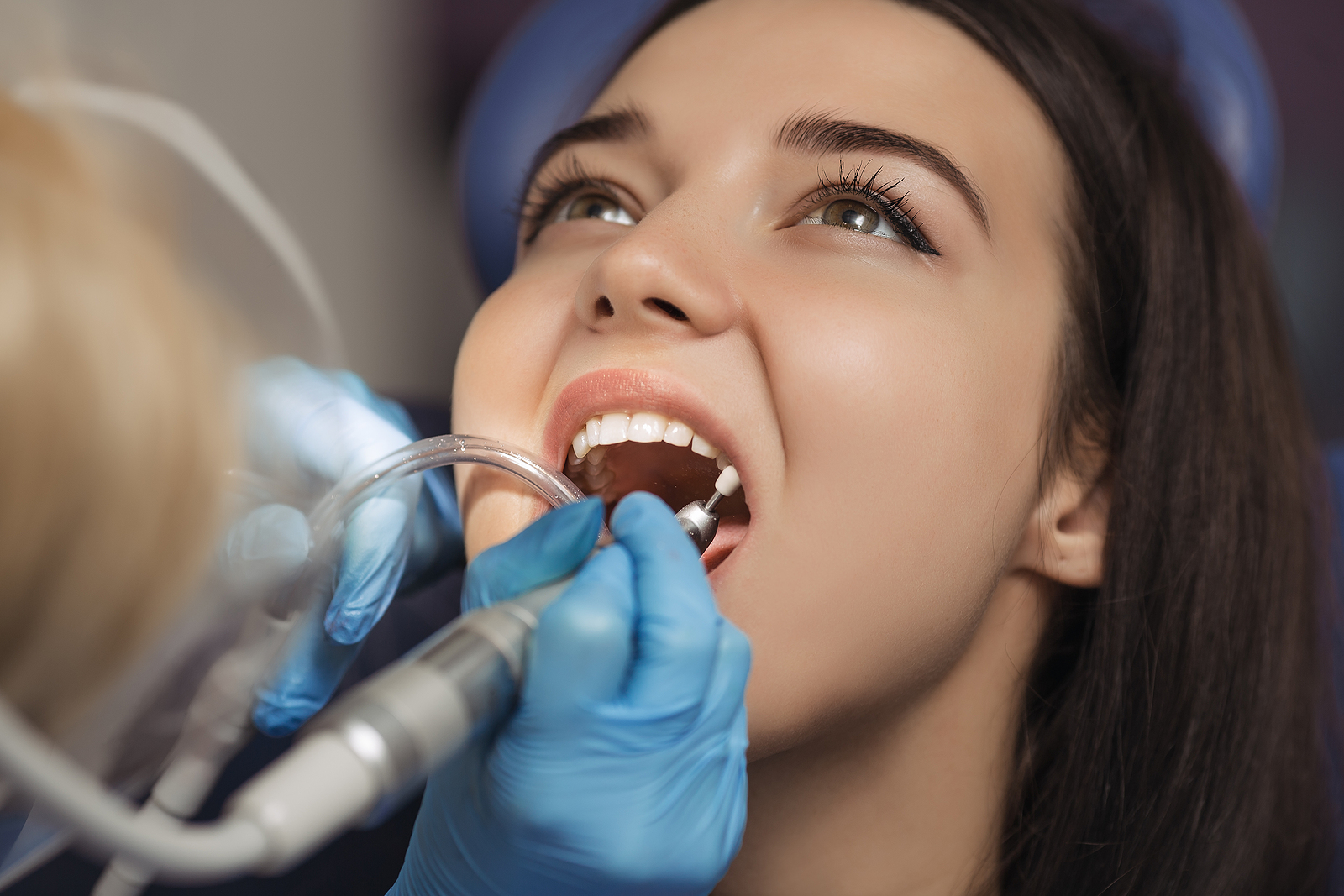 General Dentistry: The Key to Preventive Care for a Lifetime of Healthy Smiles